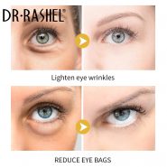 کرم ضد چروک دور چشم دکتر راشل Dr.rashl مدل Vitamin A Retinol حجم 15 گرمی